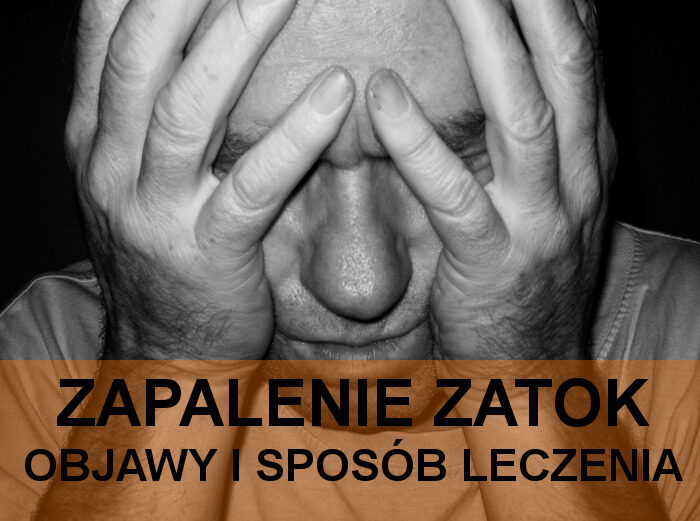 Zapalenie zatok